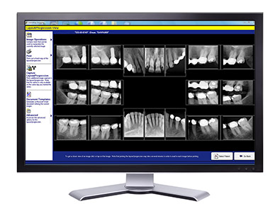 A Screen Showing a Digital X-Ray